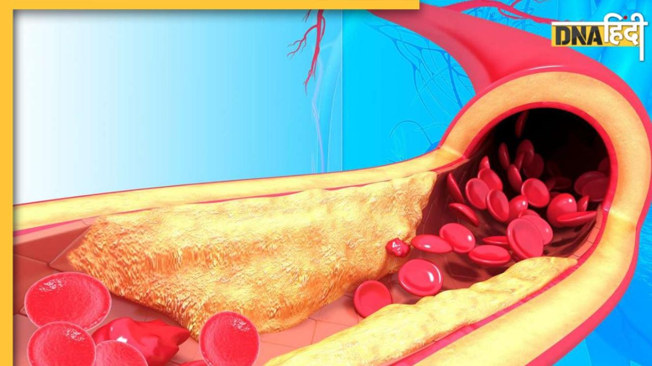 Cholesterol Remedy: हाई कोलेस्ट्रॉल से परेशान हैं? तो आप इन 10 फूड्स को खाना शुरू करें, मक्खन की तरह पिघलेगी वसा