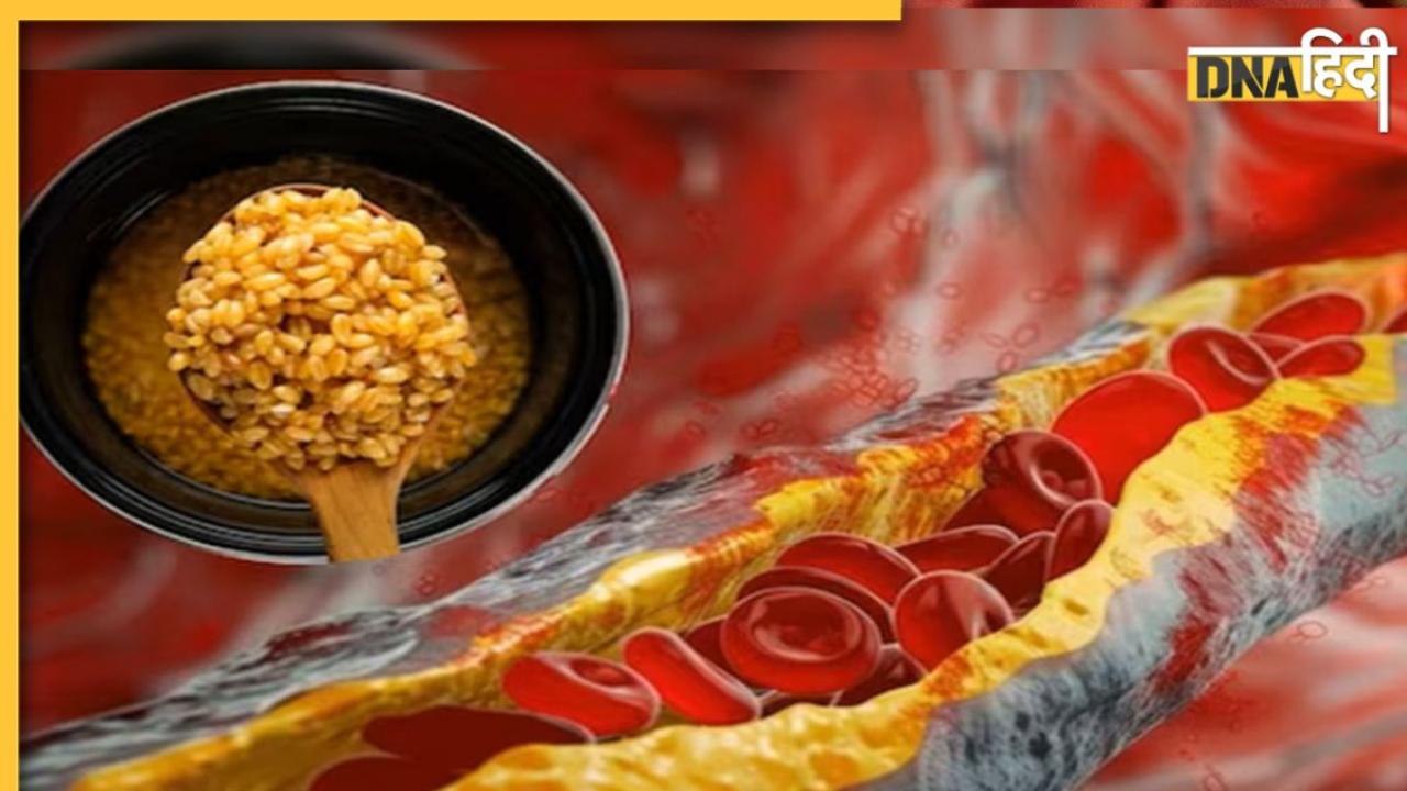 Cholesterol Home Remedy: ये पीली चीज ब्लड में फंसे गंदे कोलेस्ट्रॉल को खींच कर बाहर ले आती है, हार्ट की ब्लॉकेज भी खुलेगी
