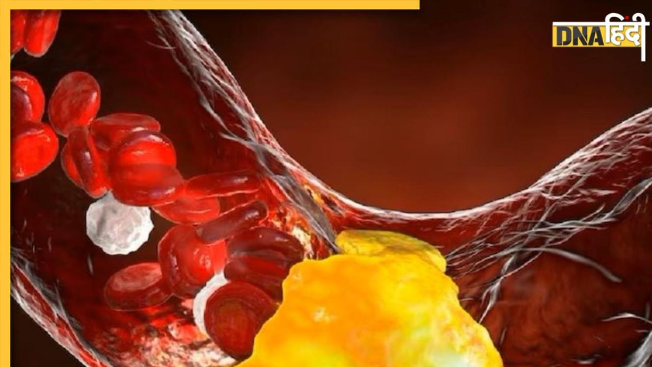 Cholesterol Remedy: धमनियों में जमा गंदा कोलेस्ट्रॉल पानी की तरह बह जाएगा, बस रोज सुबह-शाम खा लें ये काले बीज