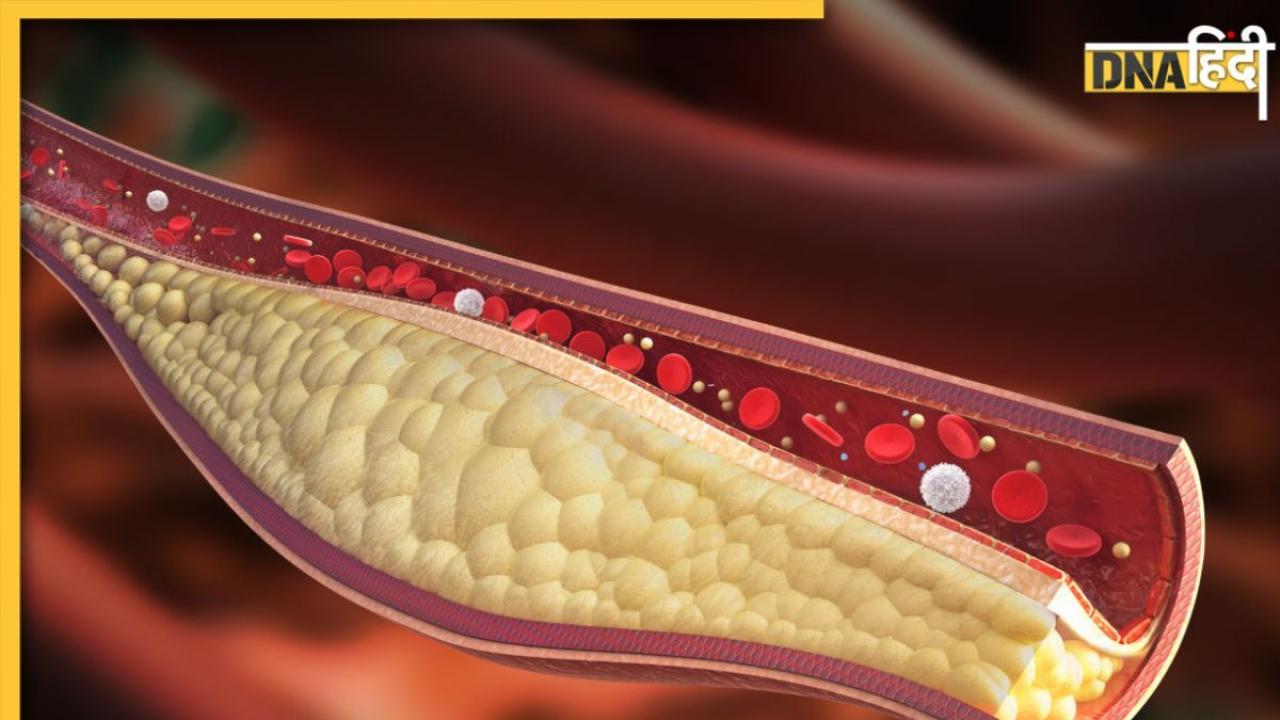 Good Cholesterol Remedy: गुड कोलेस्ट्रॉल बढ़ाती हैं ये सब्जियां, नसों में फंसा गंदा पीला फैट निकल जाएगा