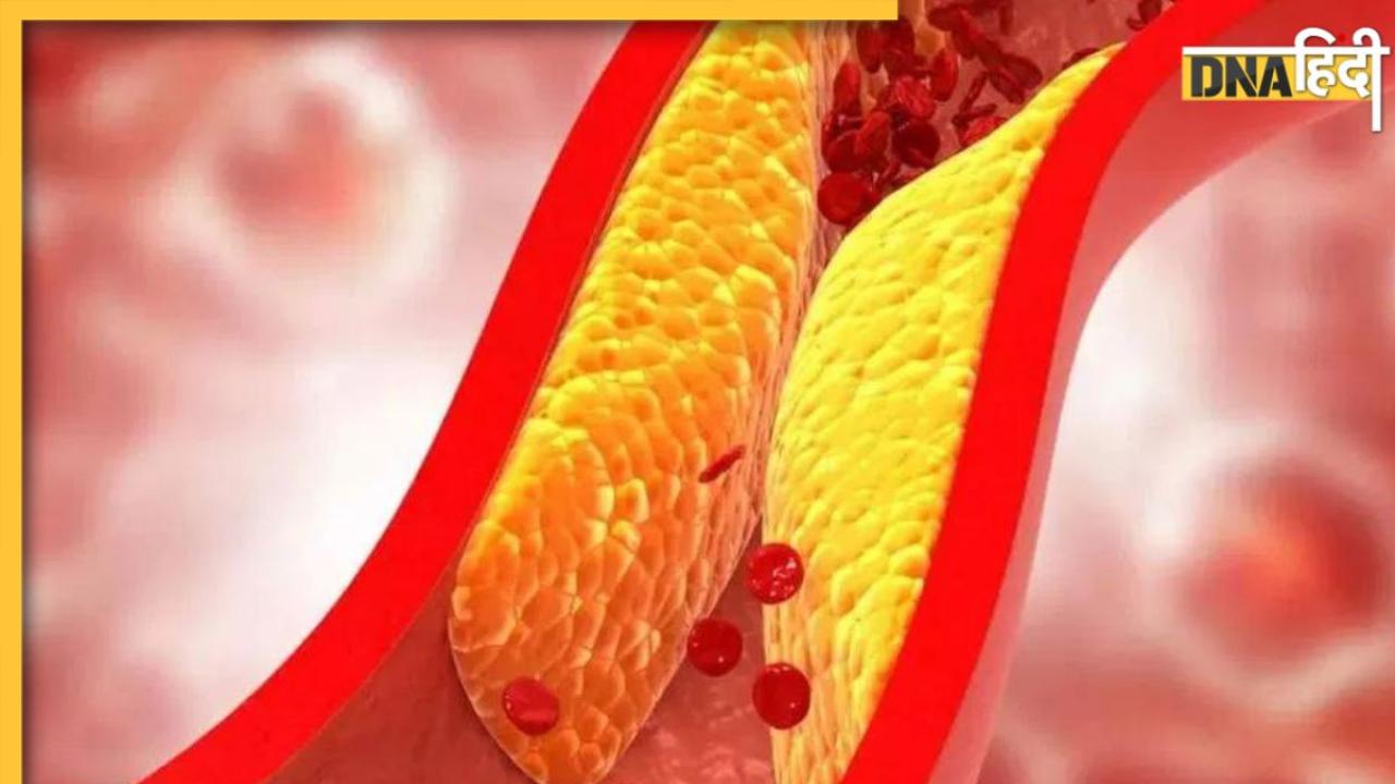Cholesterol Remedy: नसों में फंसे गंदे कोलेस्ट्रॉल को पिघला देंगे ये 6 फूड्स, बढ़ जाएगा ब्लड सर्कुलेशन