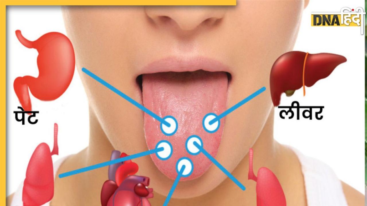 Tongue color Sign: जीभ का रंग खोल देगा सेहत की पोल, लिवर की खराबी से लेकर विटामिन की कमी तक पर दिखते हैं ये संकेत