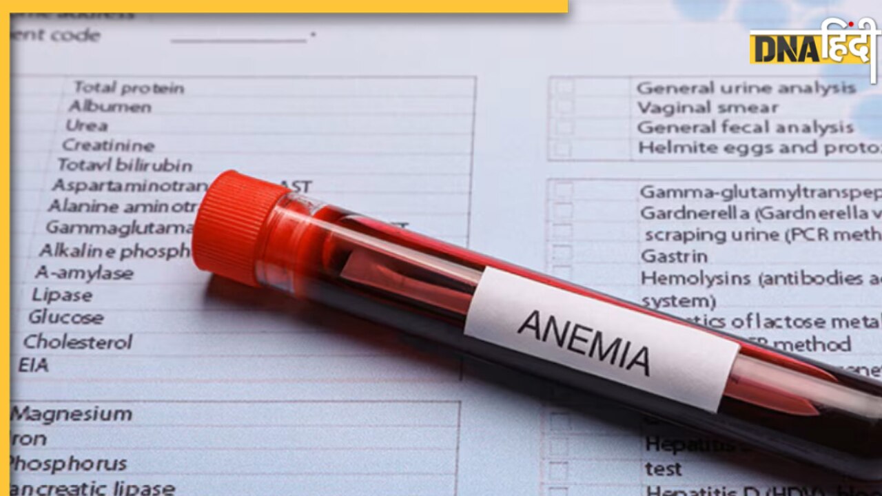 Hemoglobin Check at Home: घर पर ही चेक किया जा सकता है हीमोग्लोबिन लेवल, एक क्लिक पर स्मार्टफोन देगा रिपोर्ट