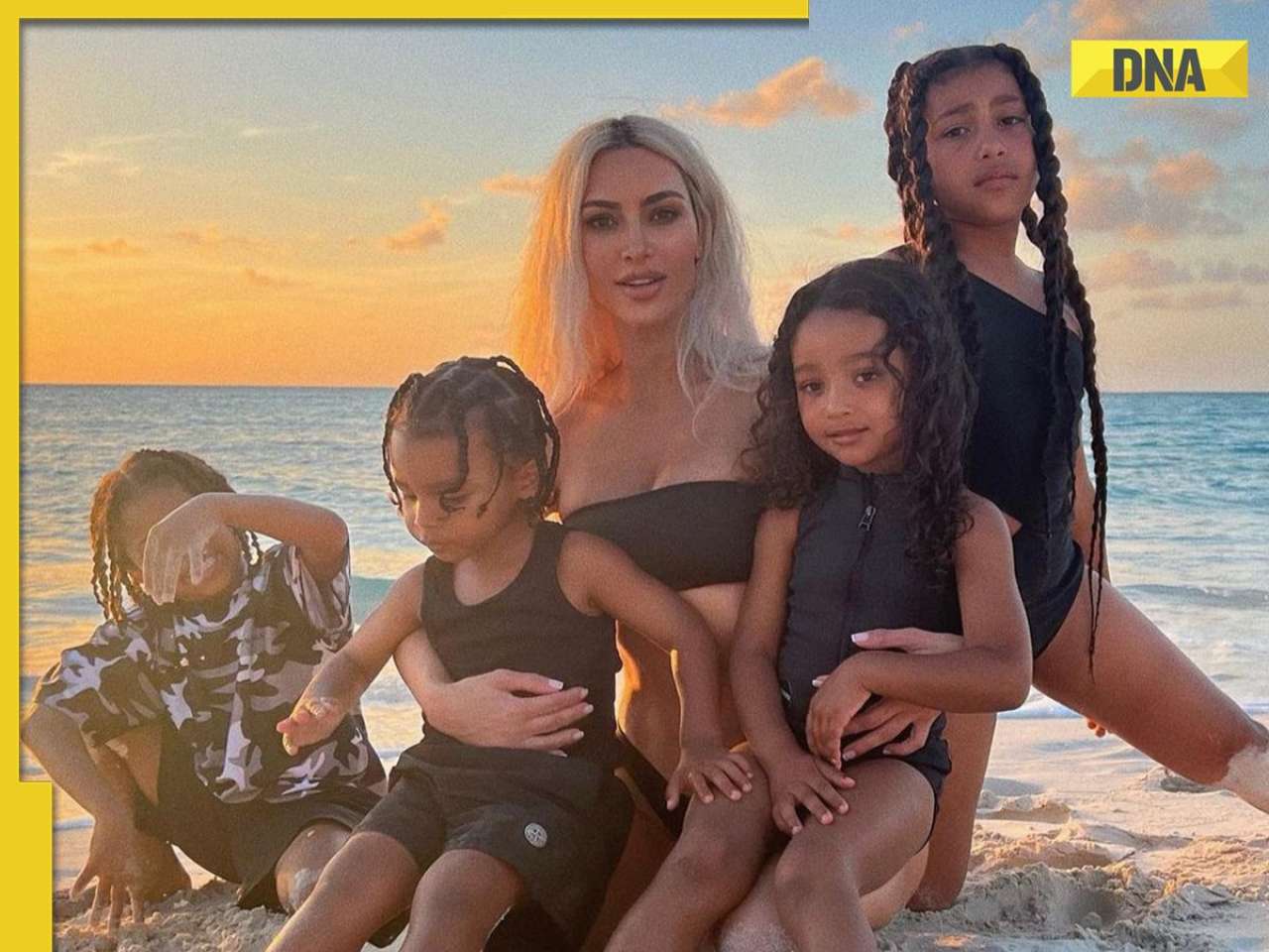 What is Vitiligo? How is Kim Kardashian and Kanye West's son affected by this rare skin condition?