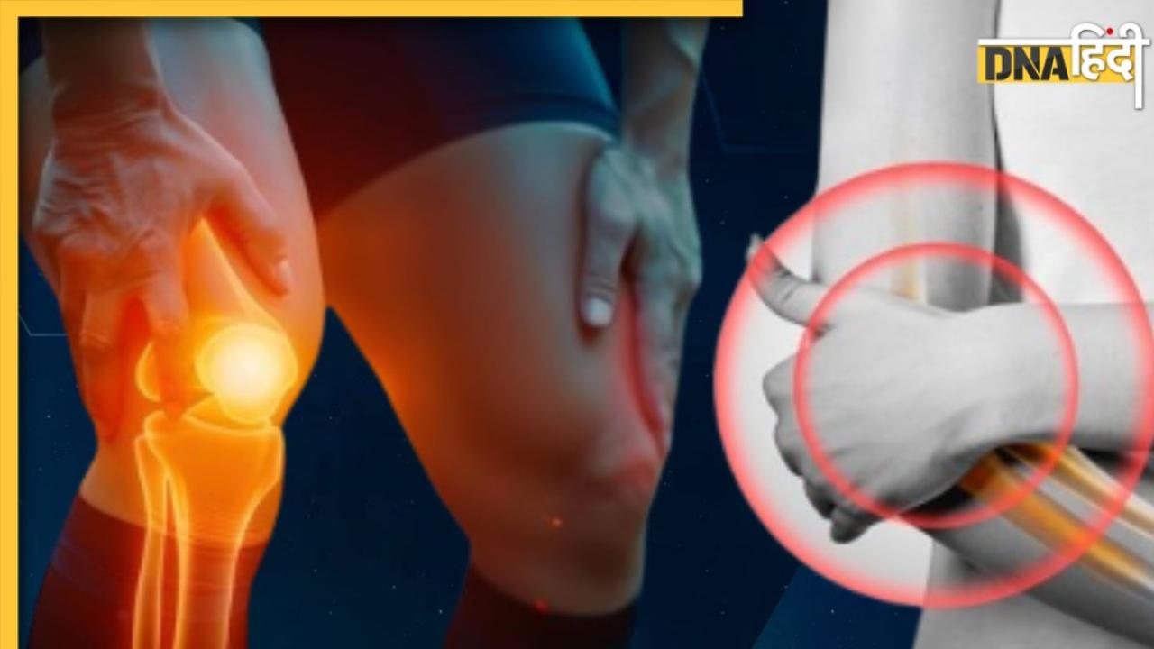 Joint Pain: हड्डियां हो रही हैं टेढ़ी, जोड़ों-घुटनों में रहता है भंयकर दर्द? कहीं इस बीमारी के लक्षण तो नहीं