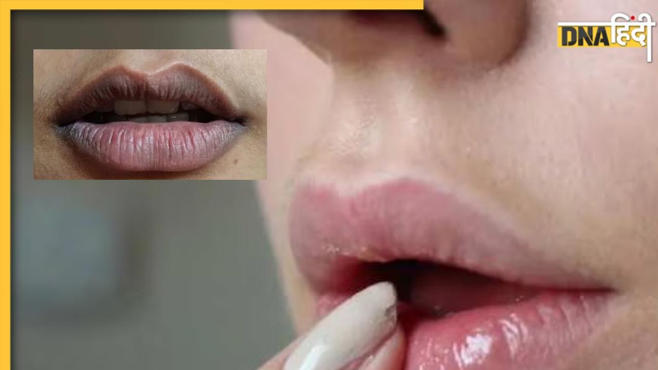 Lip Care Tips: काली पड़ गई है होठों के आसपास की स्किन? जान लें इसके कारण और दूर करने के उपाय