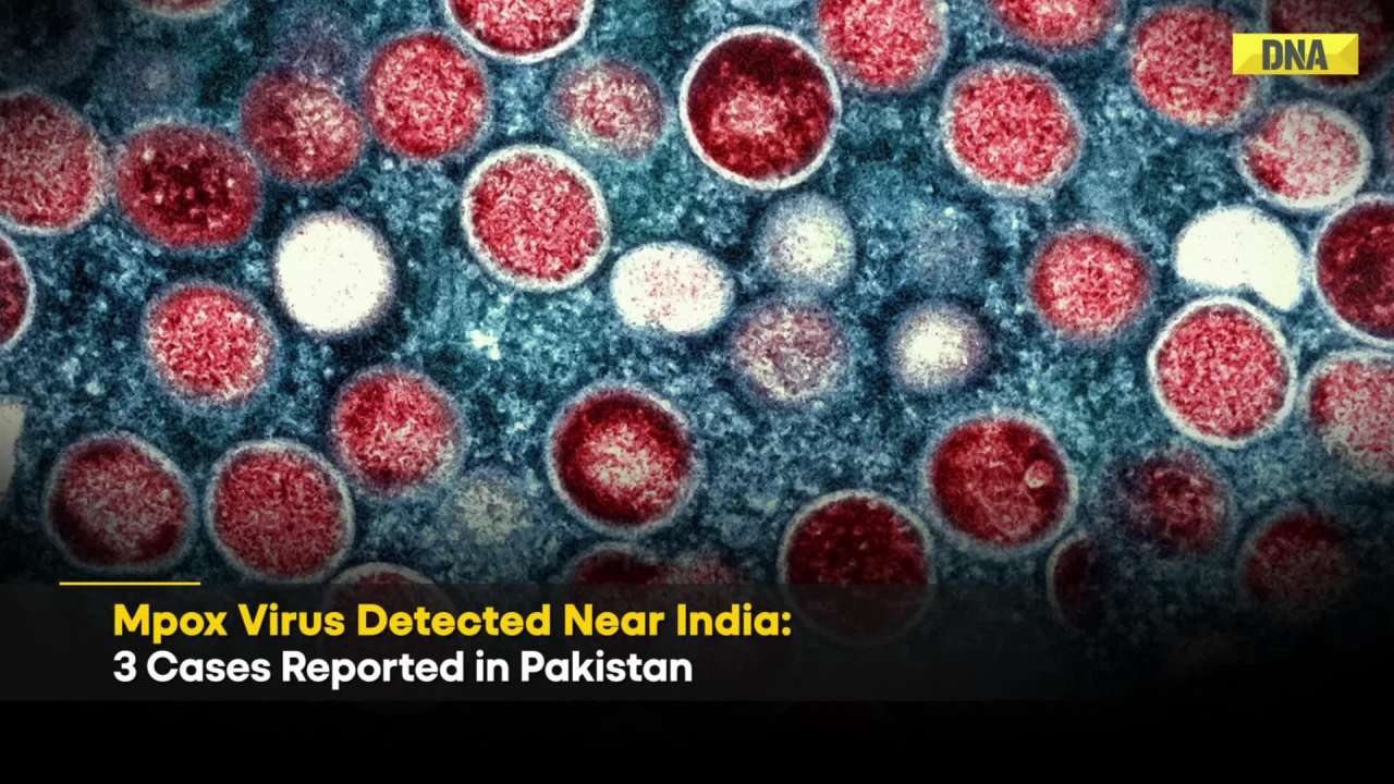 Mpox Hits Pakistan: 3 Cases Of Monkeypox Reported, Sparks Fear Of Spread In Indian Subcontinent