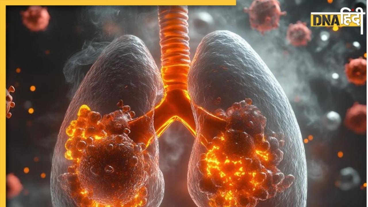 हड्डियों से लेकर सीने तक में महसूस हो सकते हैं Lung Cancer के ये लक्षण, न करें इग्नोर