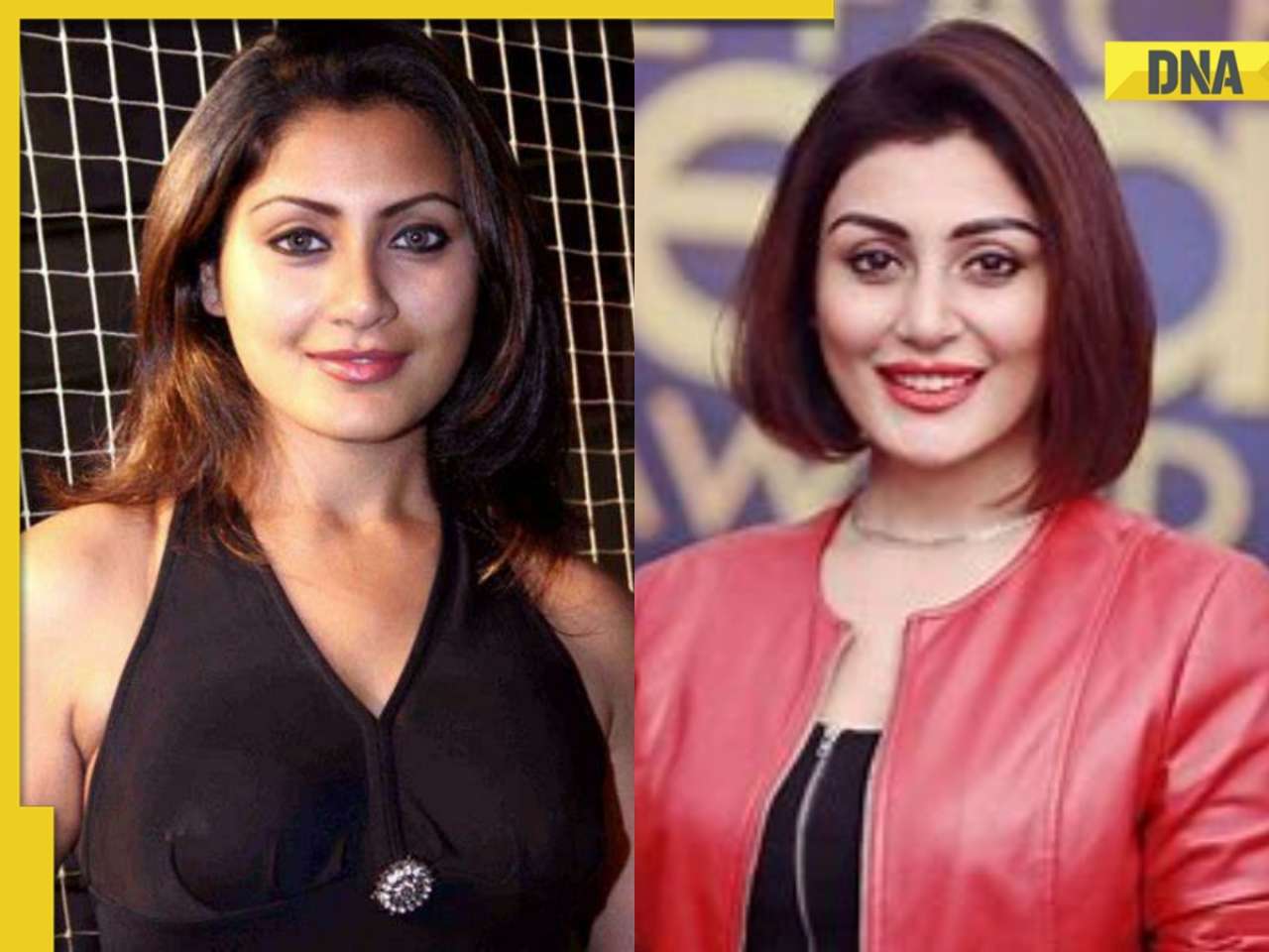 Watch: Rimi Sen surprises fans by sharing video showing face 'before and after' surgery