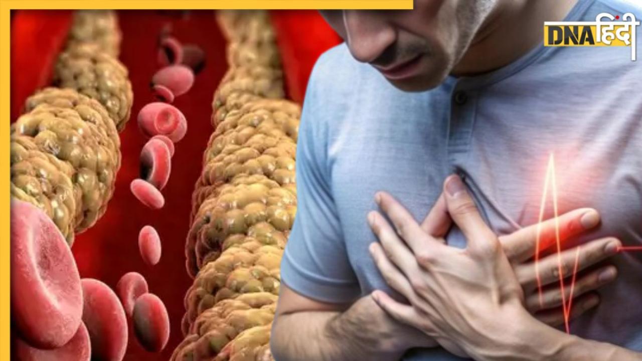 नसों में चिपके Bad Cholesterol को खत्म कर देंगे ये 5 घरेलू नुस्खे, दुरुस्त रहेगी सेहत