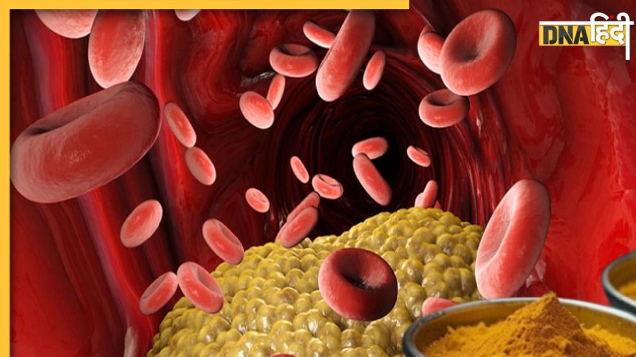 रसोई में रखे मसालों से दूर होगी Bad Cholesterol की समस्या, जानें लें कैसे करें इस्तेमाल