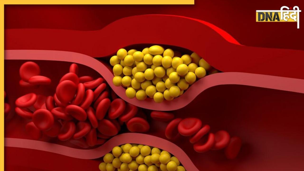 LDL Cholesterol Symptoms: चेहरे पर दिखें ये 6 लक्षण तो समझ लें शरीर में खराब कोलेस्ट्रॉल का लेवल बढ़ गया है