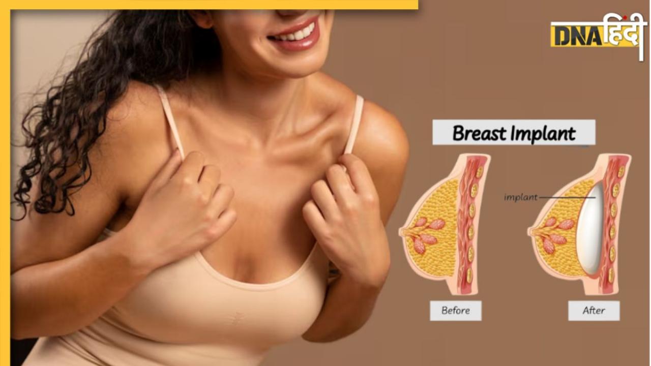 महिलाओं के बीच बढ़ रहा Breast Implant का ट्रेंड, जानें इसके क्या हैं जोखिम और कितना आता है खर्च