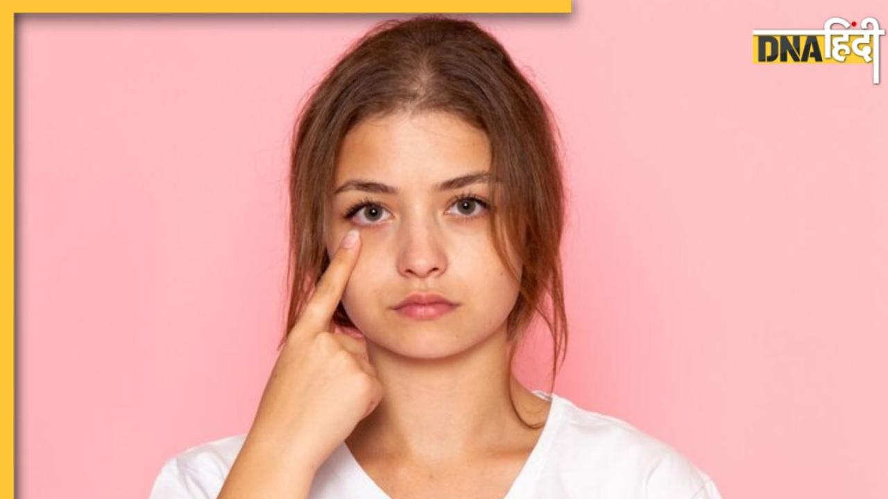 Eye Puffiness और Eyesight की समस्या होगी दूर, अपनाकर देखें ये आसान उपाय