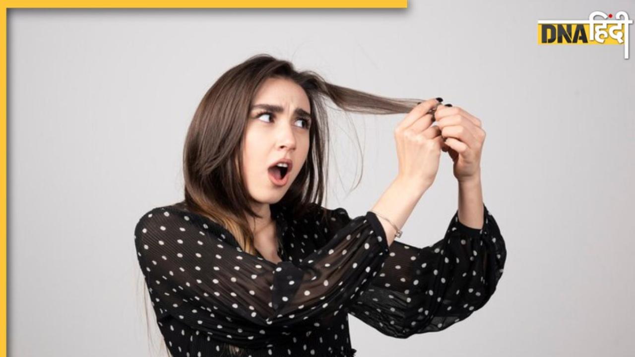 Hair fall Remedies: तेजी से झड़ रहे हैं बाल तो सरसों के तेल में मिलाकर लगाएं ये चीजें, एक हफ्ते में कम हो जाएगा हेयरफॉल 