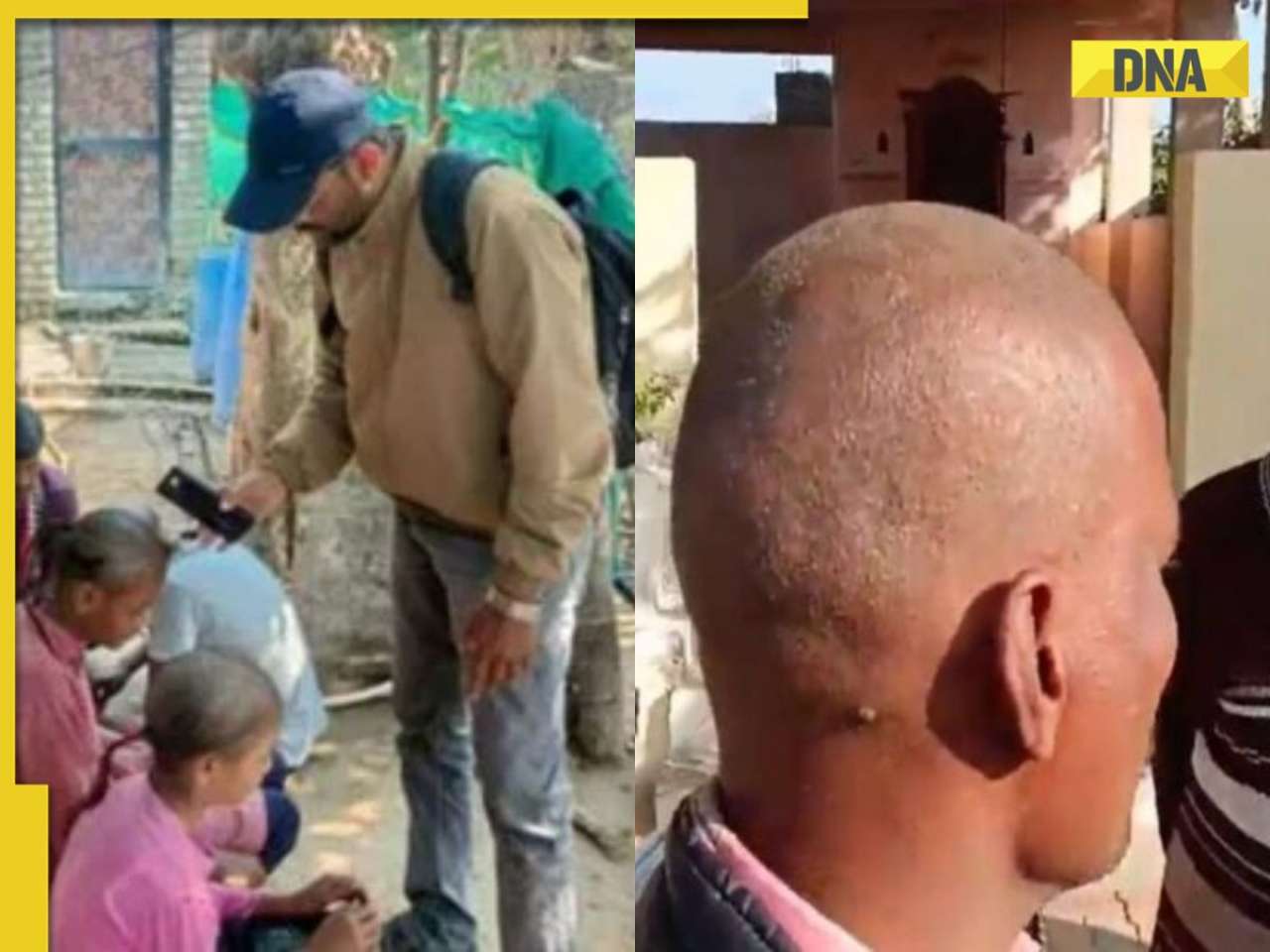 Sudden hair loss in THESE villages sparks panic, reason suspected to be...