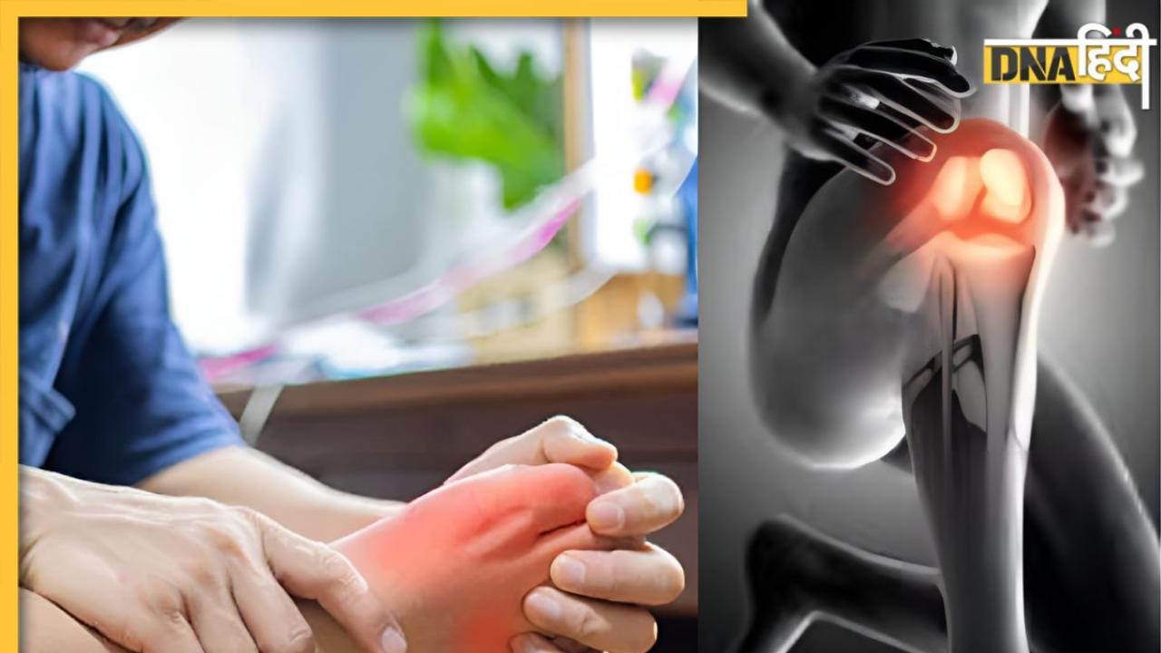 Uric Acid Remedies: इन 4 घरेलू तरीकों से कम होगा हाई यूरिक एसिड, दर्द और सूजन से मिलेगा छुटकारा