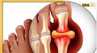 जोड़ों में चिपके Uric Acid को जड़ से खींच लेगी ये देसी चीज, ऐसे खाएंगे तो मिलेगा डबल फायदा