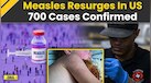  Measles Outbreak: Measles Resurfaces In US With 700 Confirmed Cases, Prevention Measures 
