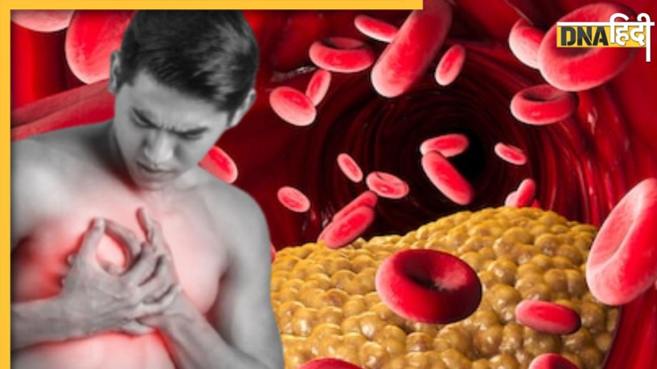नसों में जमा Bad Cholesterol को कम करेंगे रसोई में रखें ये 5 मसाले, हेल्दी रहेगा हार्ट