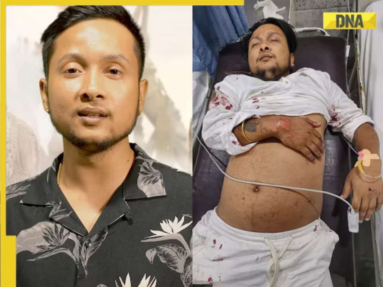 Indian Idol 12 winner Pawandeep Rajan undergoes 3 more surgeries after accident, team shares health update: 'He is still in ICU'