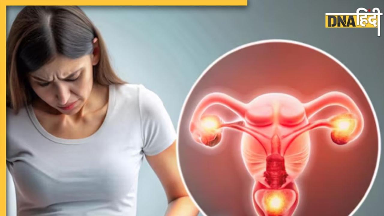 शरीर ही नहीं, दिमाग पर भी असर डालता है PCOS, कम हो सकती है सोचने-समझने की शक्ति! Study 