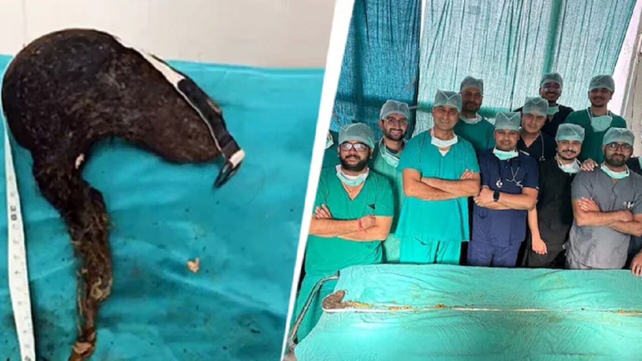 जानलेवा स्थिति में पहुंची आदत