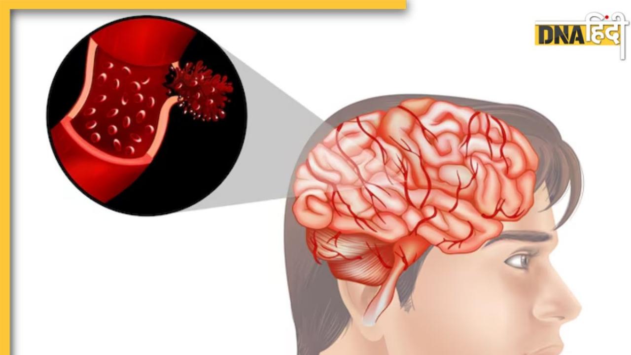 Brain Tumor: ये 5 आदतें दिमाग के लिए हैं खतरनाक, तुरंत बदलें, वरना हो सकता है ब्रेन ट्यूमर!