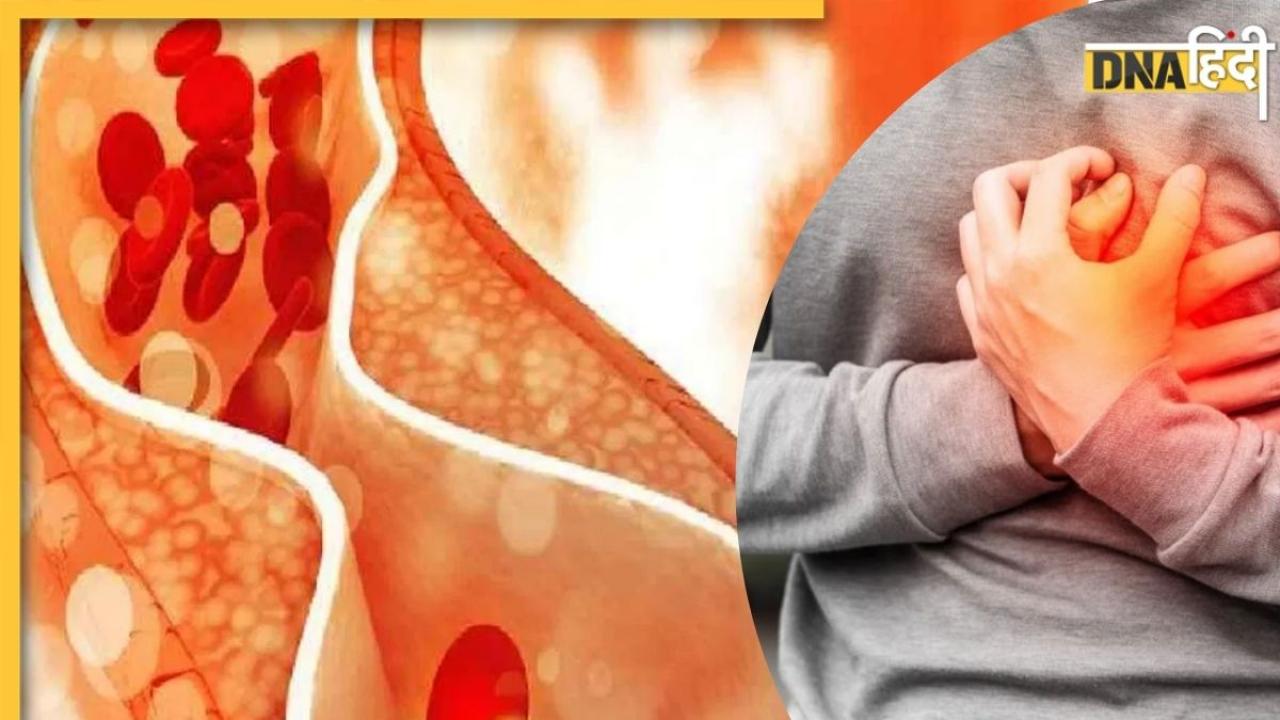 Bad Cholesterol को कम करती हैं ये 5 सब्जियां, इन्हें खाने से बेहतर होगी हार्ट हेल्थ