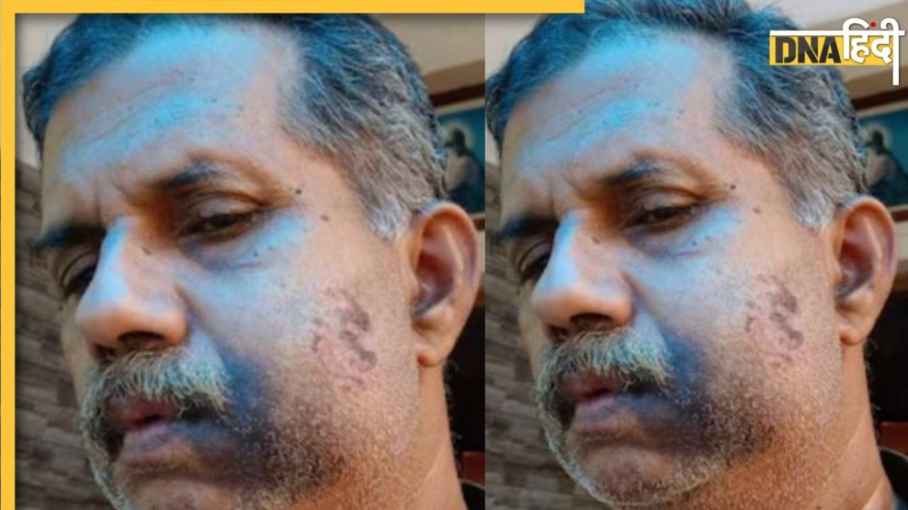 कक्षा 4 में हुई थी मारपीट, 50 साल बाद स्कूल के रीयूनियन में पीड़ित ने कुछ ऐसे लिया बदला...