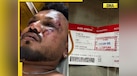  Ahmedabad Plane Crash: Who is Vishwash Kumar Ramesh, the lone survivor in Air India aircraft accident? 