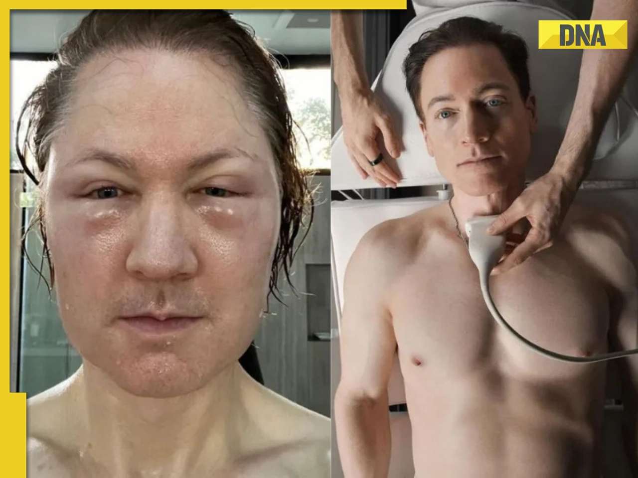 Tech millionaire who wants to live forever spends Rs 172200000 daily on...; takes 40 pills, wakes up at...