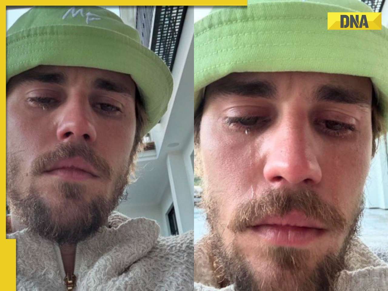 Justin Bieber says he is 'broken and tired', pens emotional note: 'My whole life...'