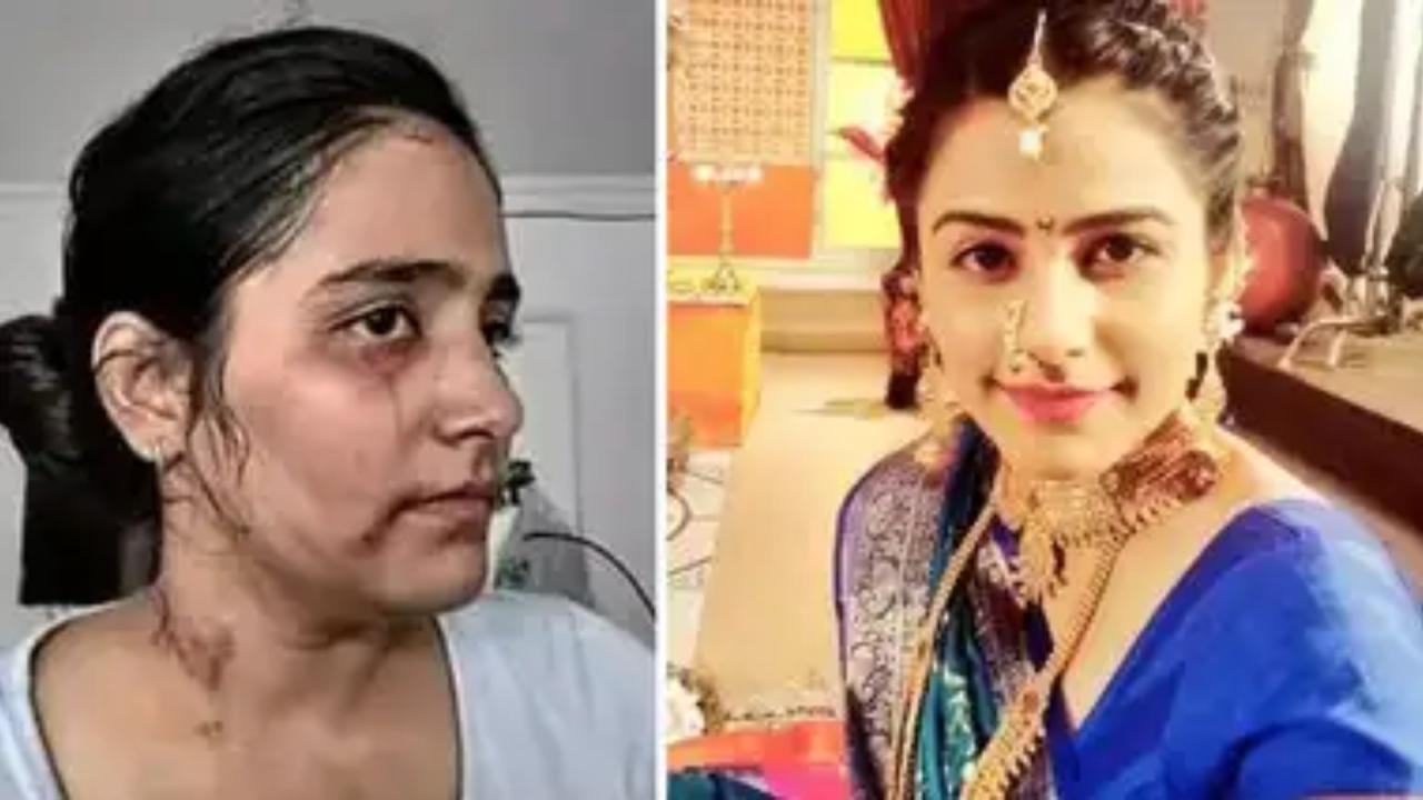 Preity Talreja Brutally Beaten By Husband 