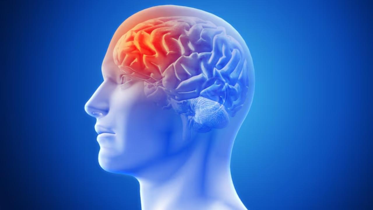 क्या है ब्रेन एन्यूरिज्म? 