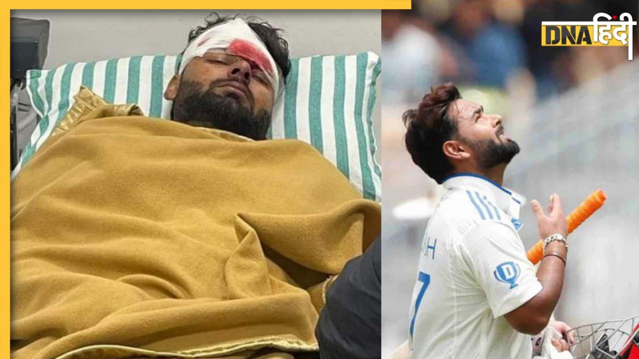 कार एक्सीडेंट के बाद ऋषभ पंत का क्या था सर्जन से पहला सवाल, डॉक्टर ने खुद किया खुलासा 