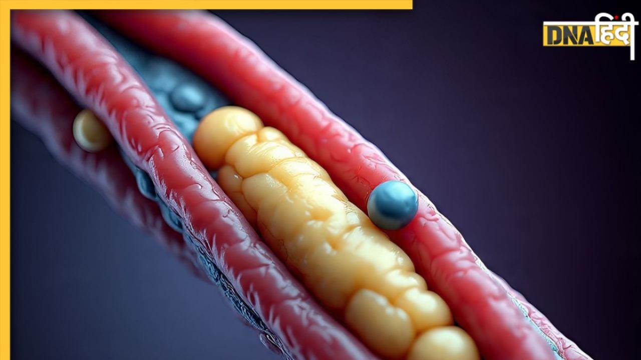 इन संकेतों से पहचानें High Cholesterol के लक्षण, हार्ट अटैक के खतरे से बच सकते हैं आप