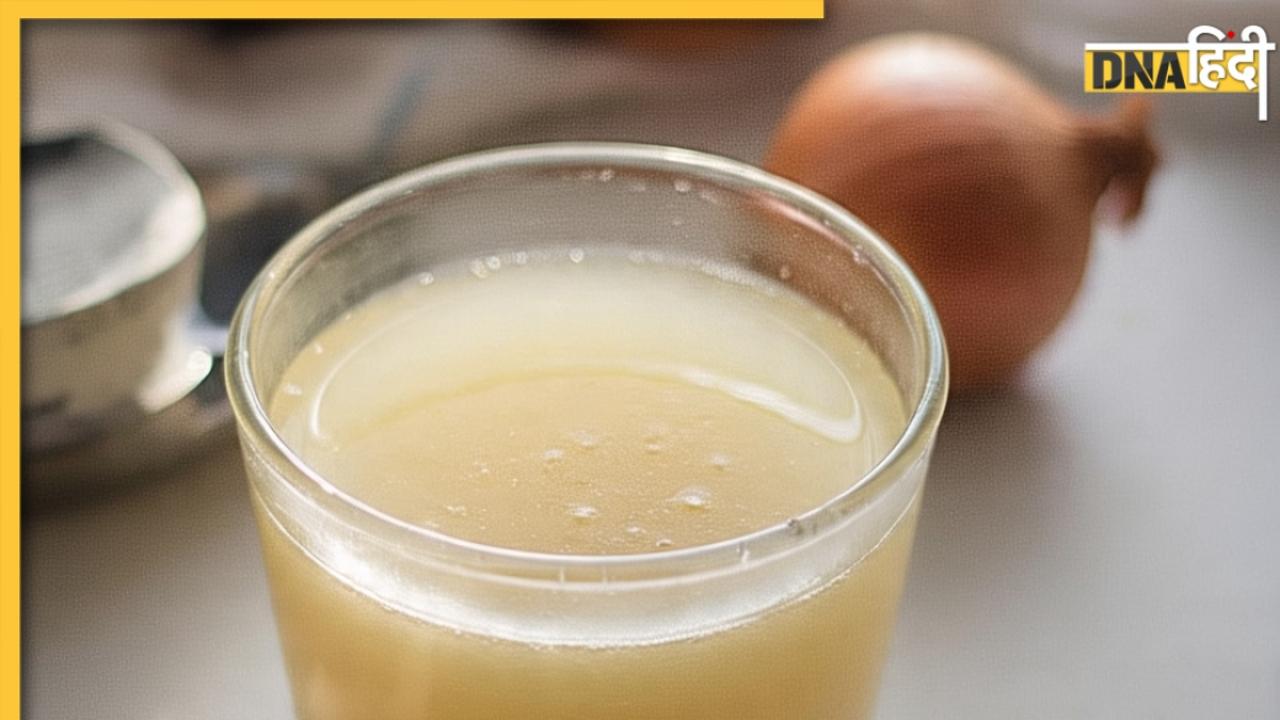 Onion Juice: वरदान से कम नहीं प्याज का रस, ऐसे करेंगे इस्तेमाल तो ये 5 दिक्कतें झट से होंगी दूर