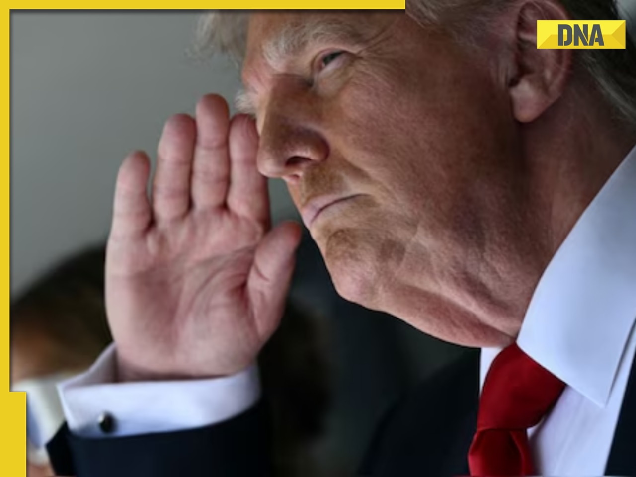 What is chronic venous insufficiency, condition Donald Trump has been diagnosed with? Know its symptoms, risk factors, more