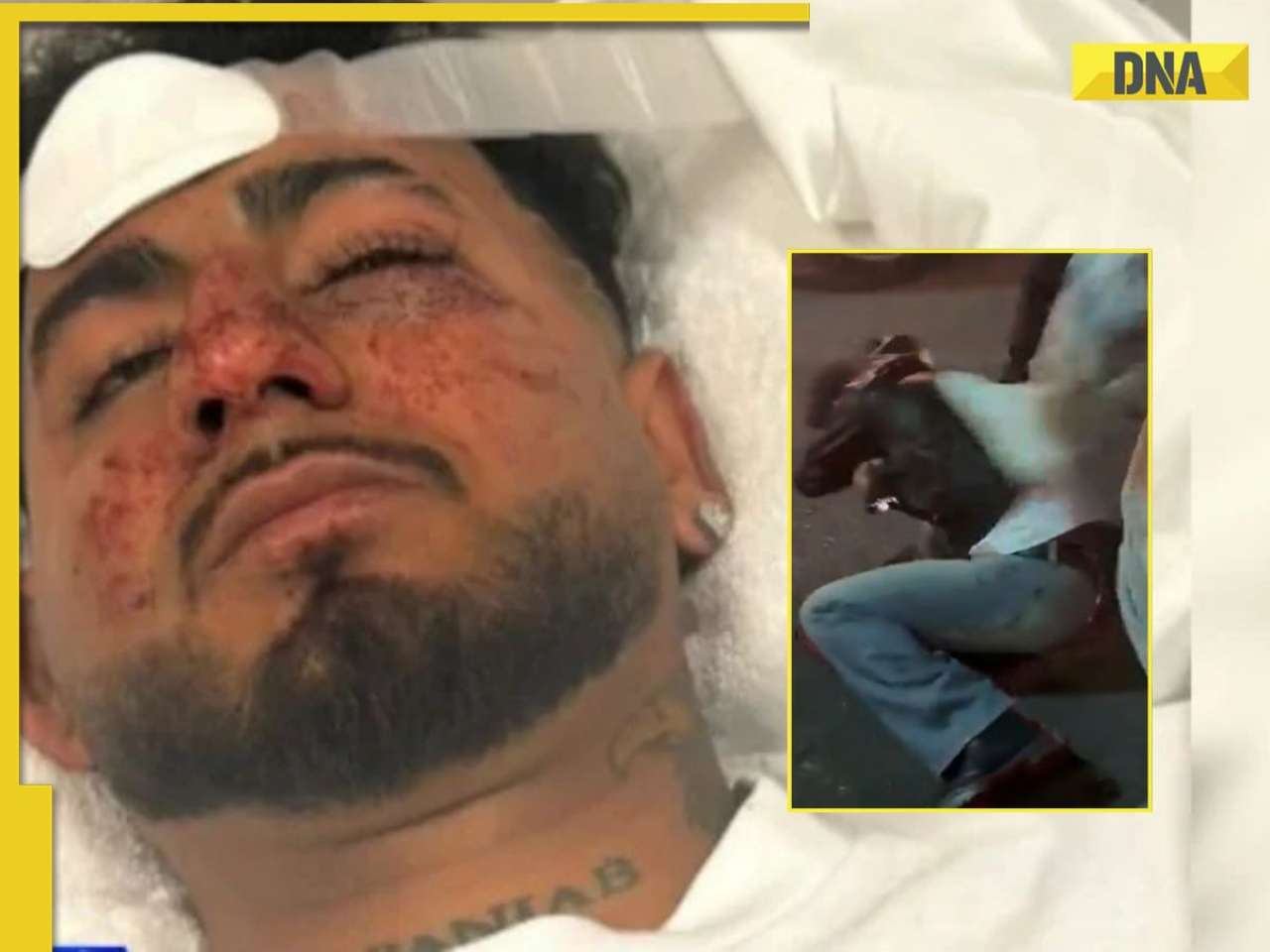 Who is Charanpreet Singh? Indian man brutally assaulted and racially abused in Australia, says, 'told me to  f--- off...'