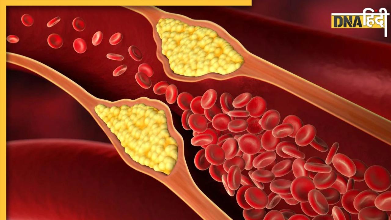 इन 8 तरह के बीजों को खाकर कम कर सकते हैं Bad Cholesterol, जानें क्या है सीड्स खाने का सही तरीका?