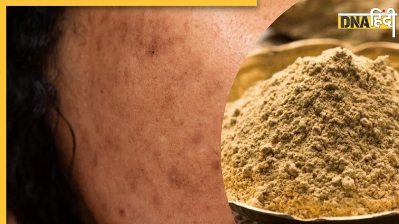 Multani Mitti for Dark Spots: चेहरे के काले दाग-धब्बे हटाने के लिए इस्तेमाल करें मुल्तानी मिट्टी, मिलेगी बेदाग और निखरी त्वचा