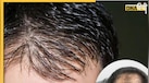 Hair Growth Tips: गंजी खोपड़ी पर बाल उगाने में मदद करेंगे ये 7 टिप्स, तेजी से होगी हेयर ग्रोथ