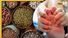 High Uric Acid वालों का और भी बुरा हाल कर सकती हैं ये 5 दालें, आज से ही छोड़ दें खाना