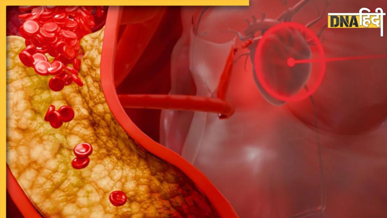 बैड कोलेस्ट्रॉल के जोखिम