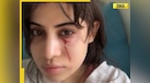  Bloodied face, bruises under eyes: Urfi Javed brutally attacked by her own... 