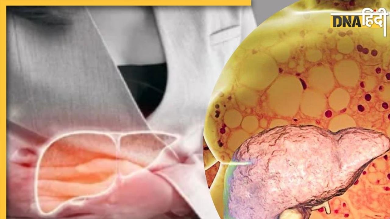 Fatty Liver Signs: लिवर में फैट बढ़ने पर बॉडी में नजर आते हैं कई लक्षण, समय रहते कर लें पहचान, वरना...
