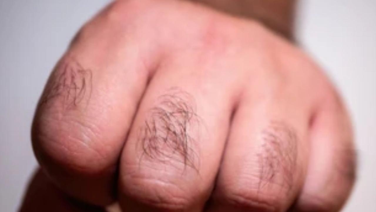 उंगलियों पर घने और मोटे बाल