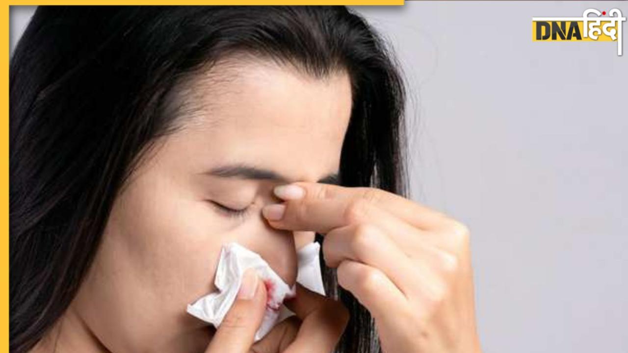 Nasal cancer: ये 10 लक्षणों नाक के कैंसर का शुरुआती संकेत हैं, 99 % लोग इसे हल्के में ले कर नजरअंदाज कर देते हैं