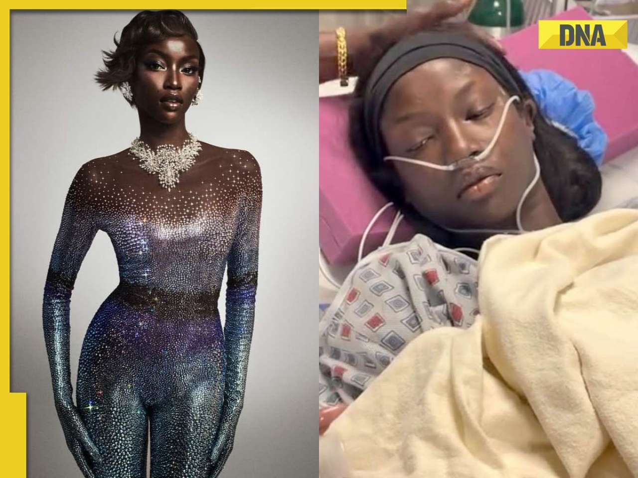Who is Anok Yai? 28-year-old supermodel reveals health battle, congenital lung defect